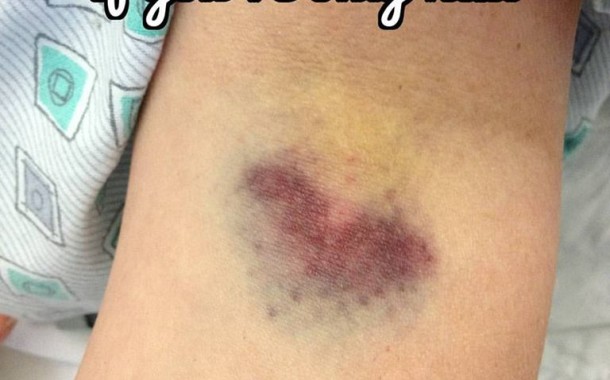 Paper Cuts Hurt - Nina Update